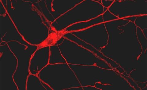 一只活苍蝇的痛觉感受器(痛觉)神经元. 照片由Courtney Brann ' 18. 